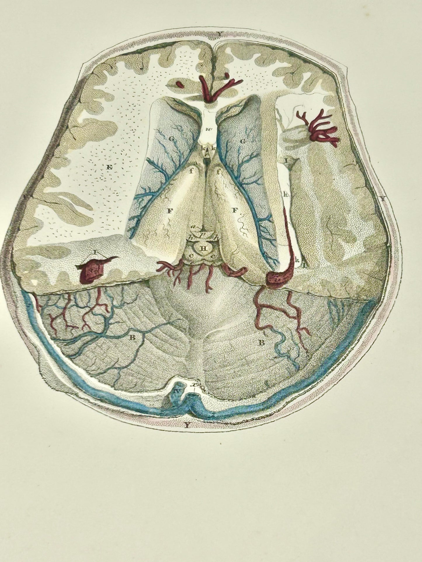 Lizars Anatomical Drawing  - The Brain Plate LXIII- Original 19th Century Medical Illustration