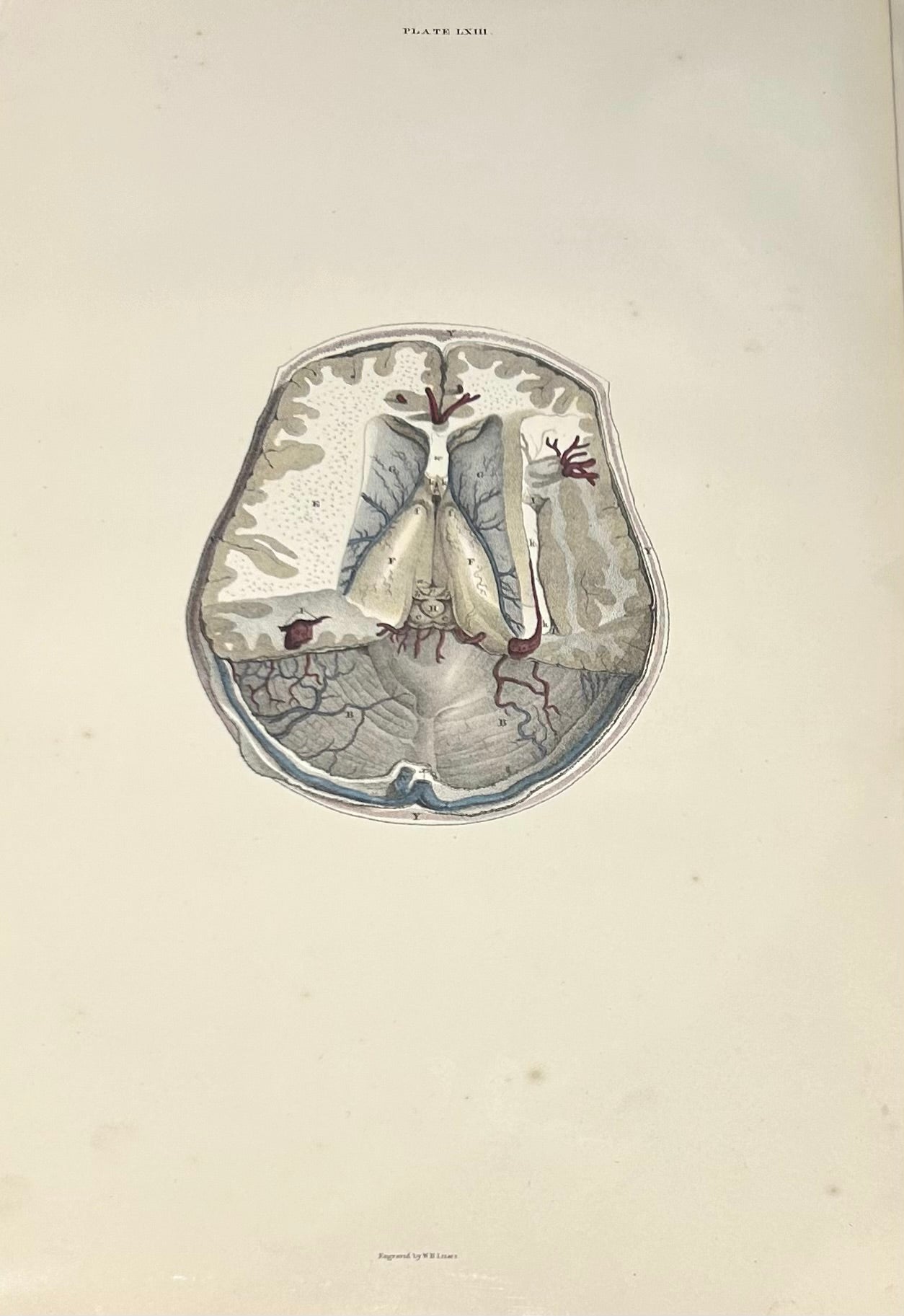 Lizars Anatomical Drawing  - The Brain Plate LXIII- Original 19th Century Medical Illustration