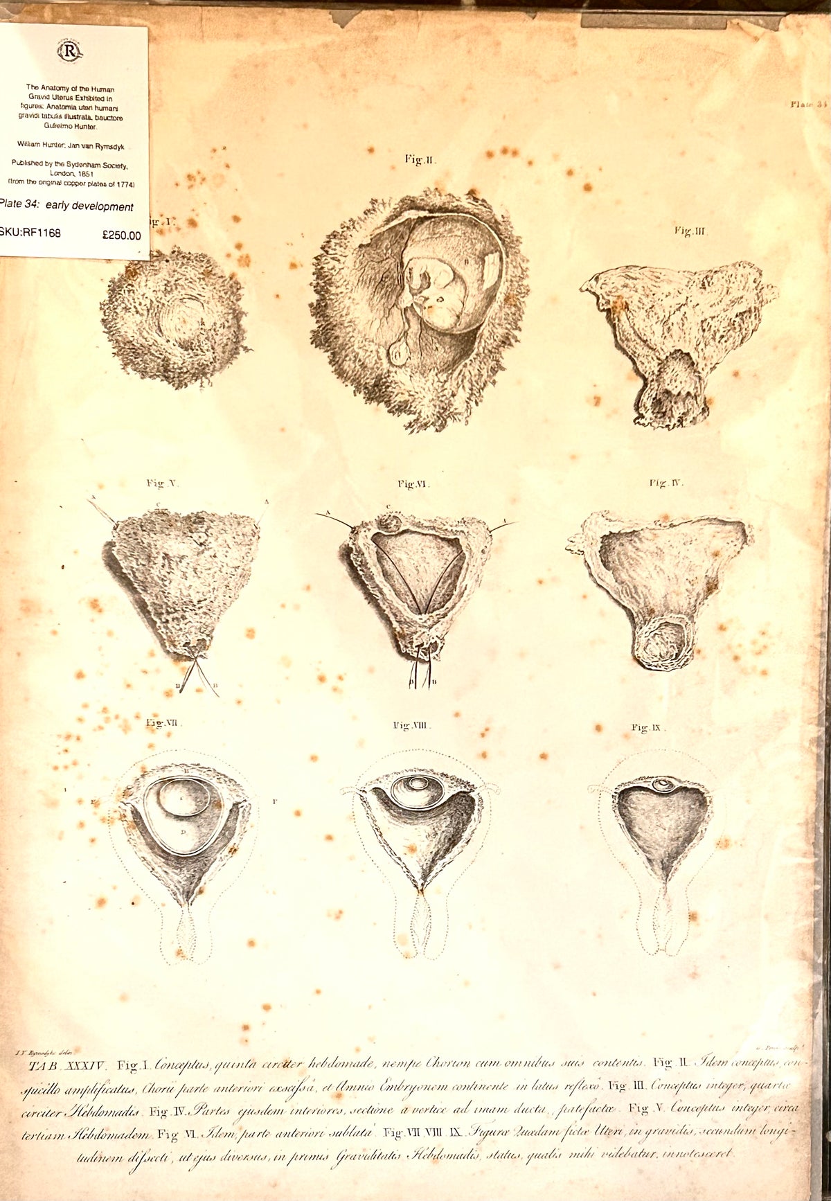 Menschliche Gebärmutter in der Schwangerschaft – Anatomische Zeichnungen von William Hunter, Tafel 34
