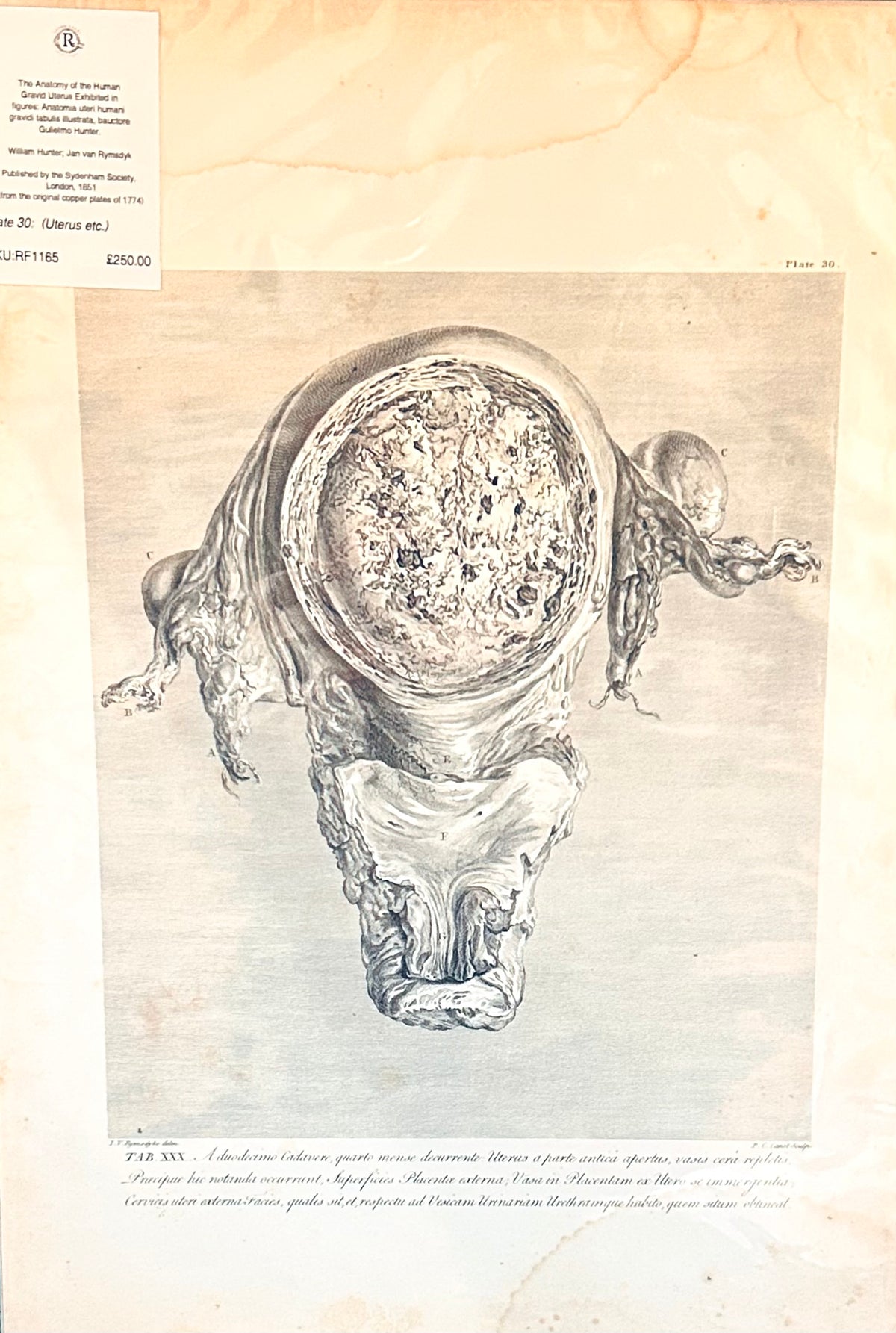 Human Gravid Uterus - William Hunter Anatomical Drawing Gravid Uterus  Tab XXX  Plate 30