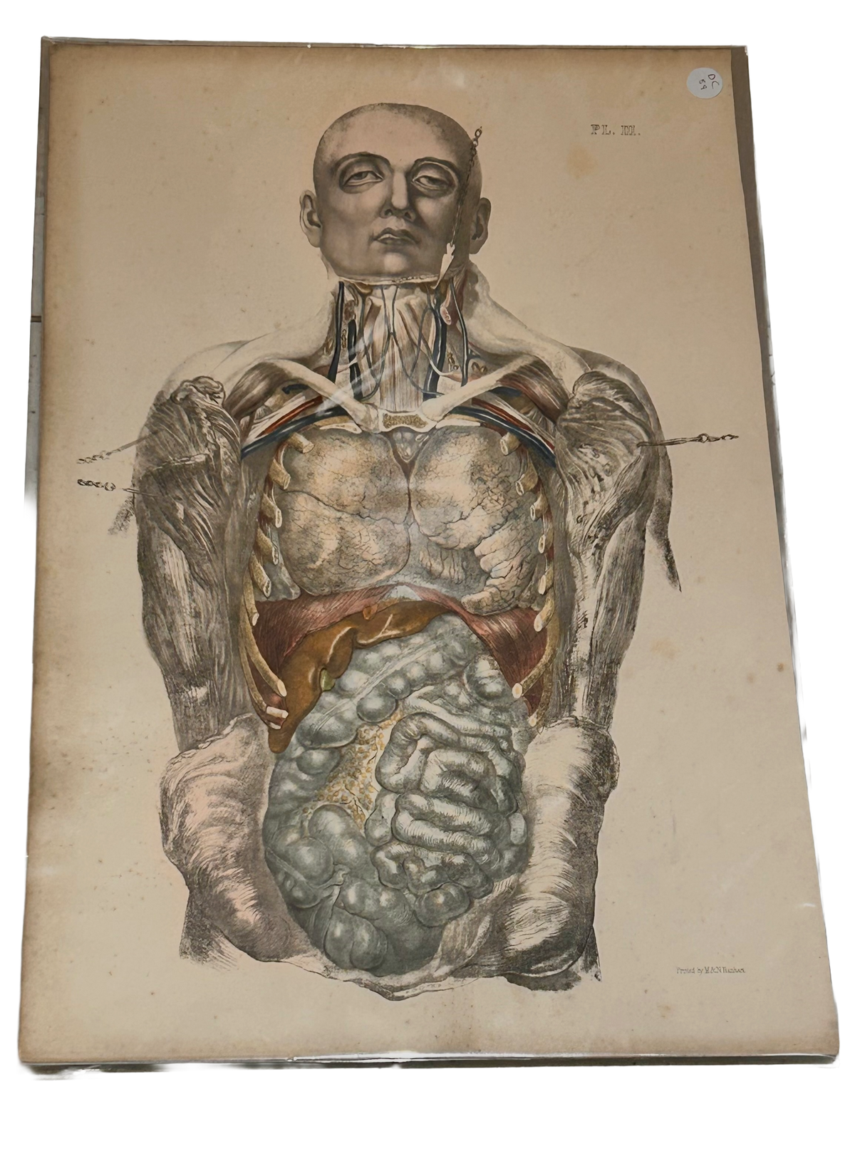 Frances Sibson Antique Anatomical Print – Plate III, 19th Century Dissection Illustration