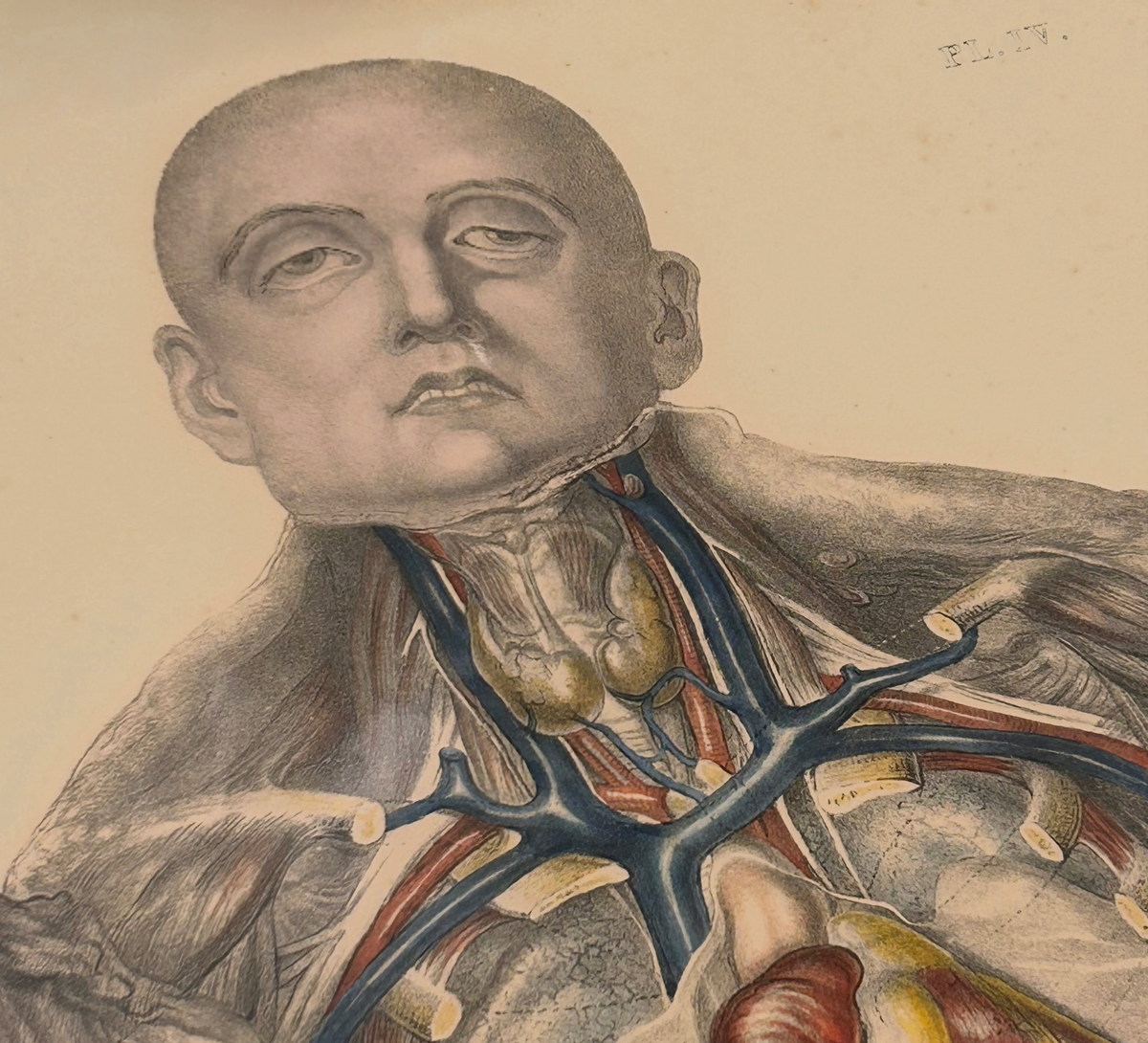 Frances Sibson Antique Anatomical Print – Plate IV, 19th Century Dissection Illustration