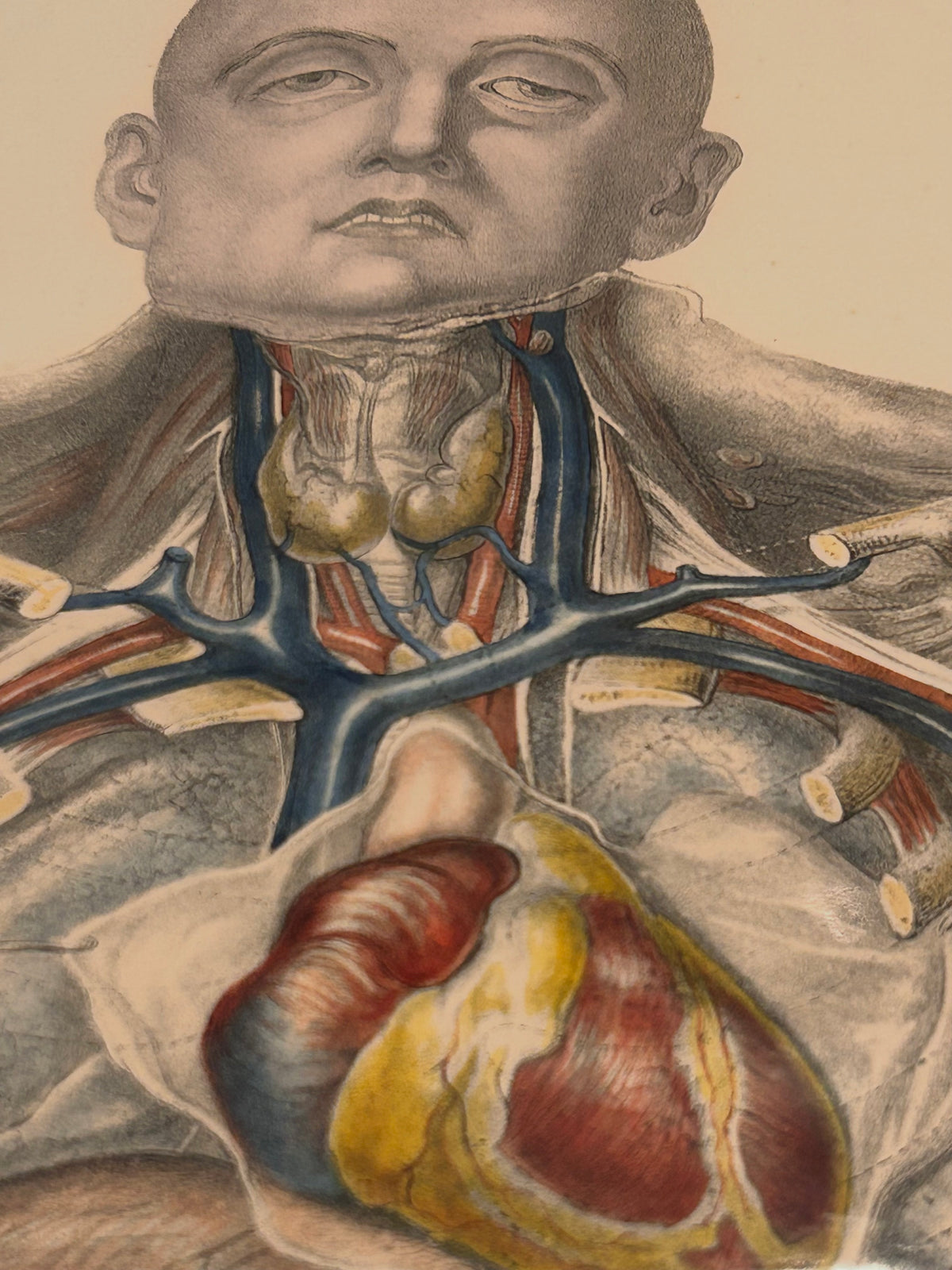Frances Sibson Antique Anatomical Print – Plate IV, 19th Century Dissection Illustration