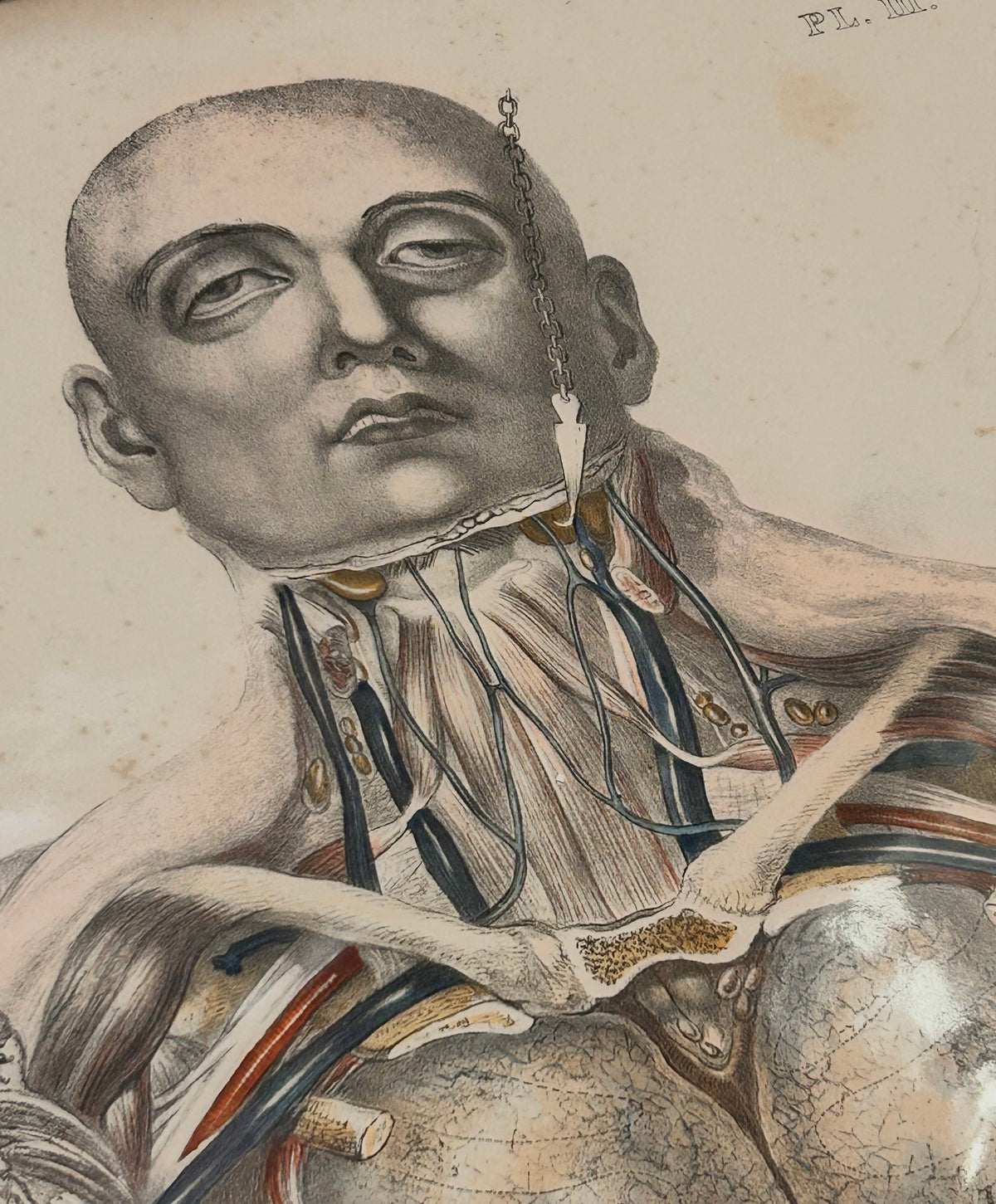 Frances Sibson Antique Anatomical Print – Plate III, 19th Century Dissection Illustration