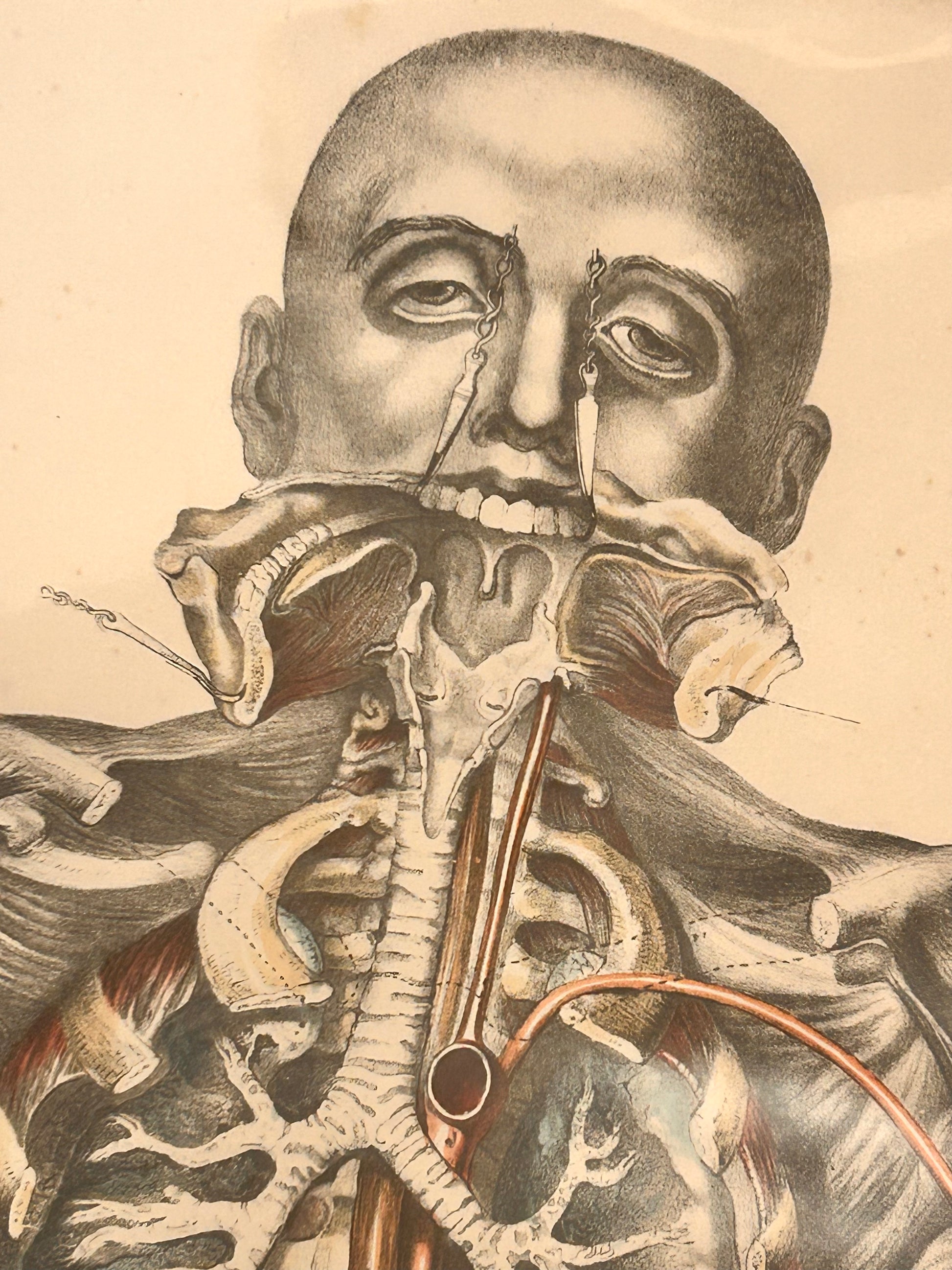 Frances Sibson Antique Anatomical Print – Plate VII, 19th Century Dissection Illustration