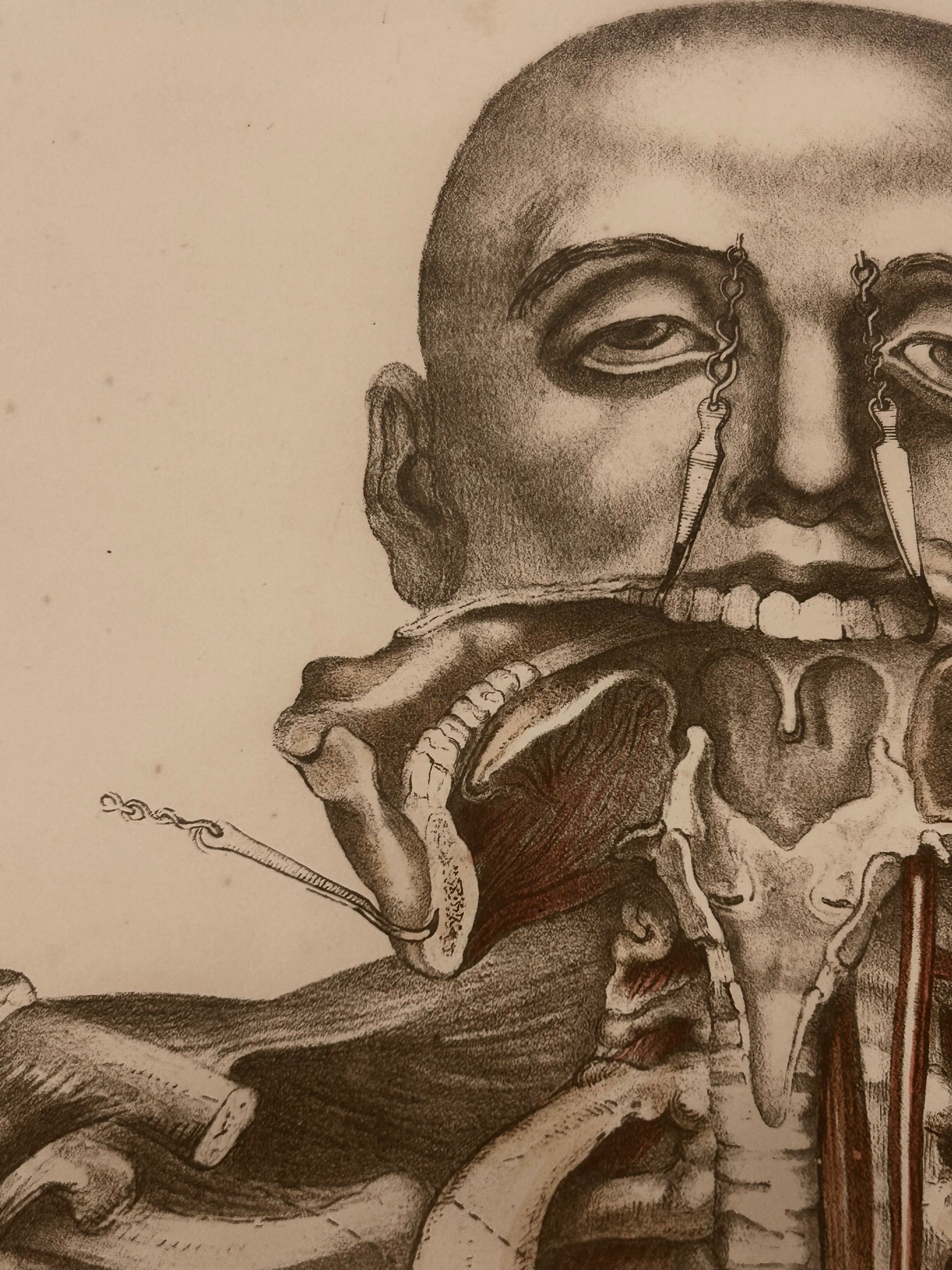 Frances Sibson Antique Anatomical Print – Plate VII, 19th Century Dissection Illustration