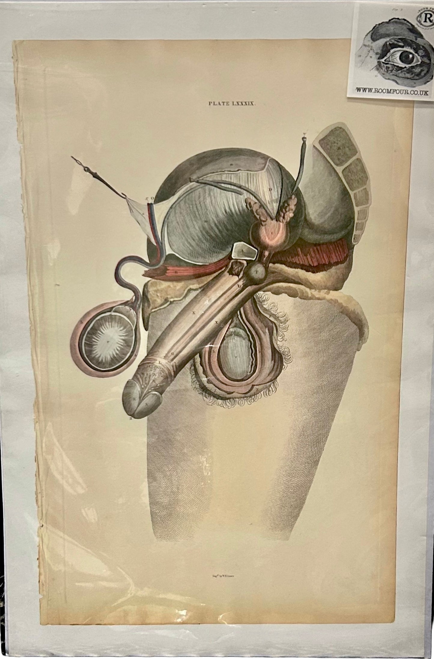 Lizars Plate LXXXIII – Side View Anatomical Illustration Male Reproductive Anatomy| Giclee Print