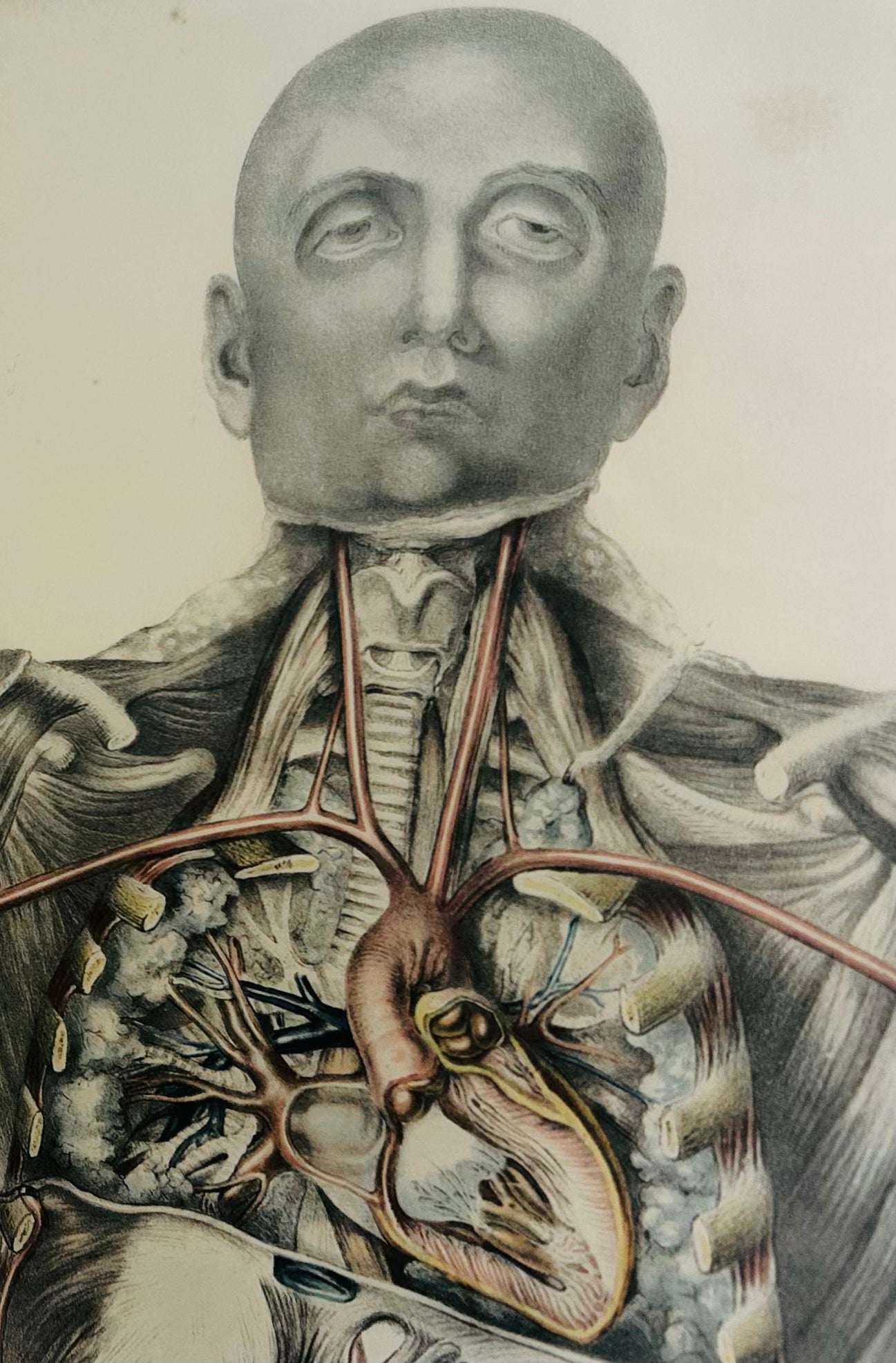[Sibson] Victorian Medical Anatomical Print – Dissection Plate VI (1869)