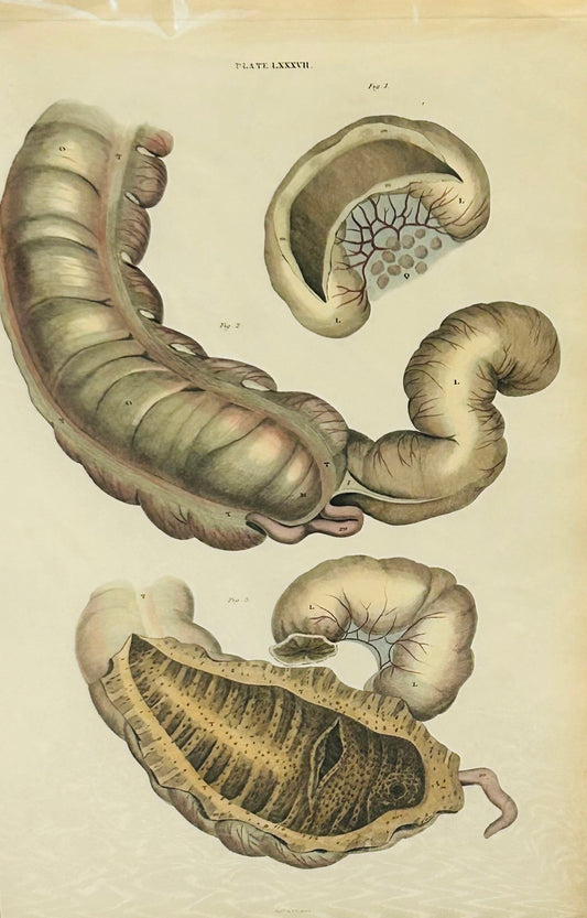 John Lizars – Original Hand-Coloured Anatomical Print (1820s) – Human Digestive System