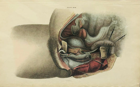 Original 19th Century Lizar's Anatomical Print – Plate XCIII – Human Abdominal Cavity & Internal Organs