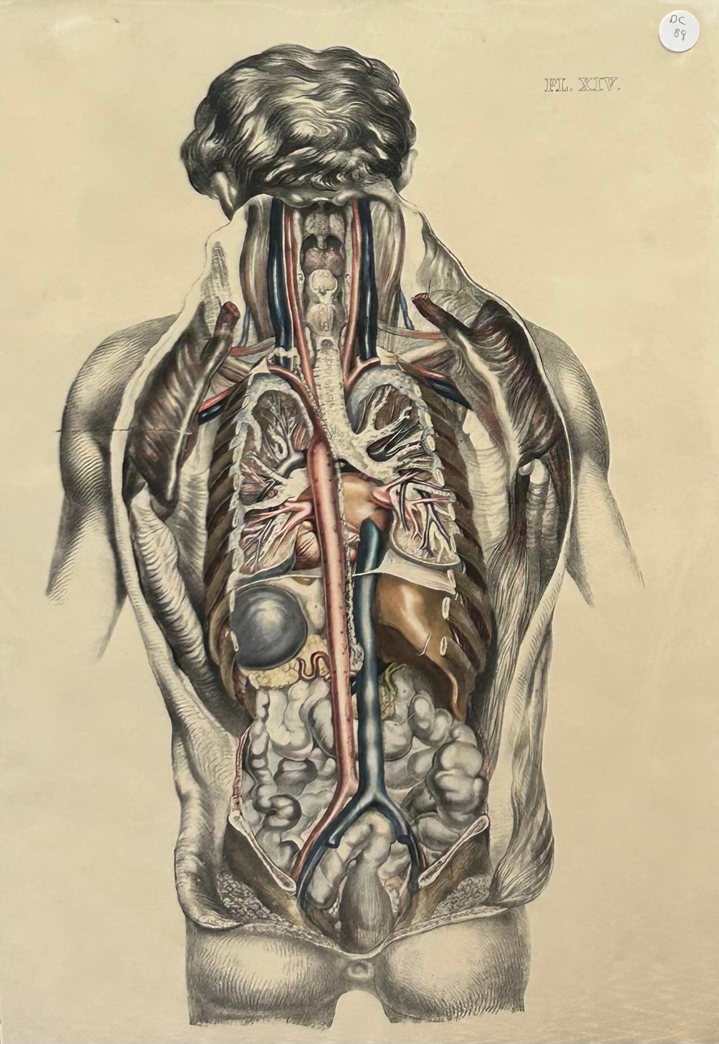 Anatomical Post Mortem Illustration by Sibson Internal Organs/Nervous System/Vascular - 19th Century Plate XIV