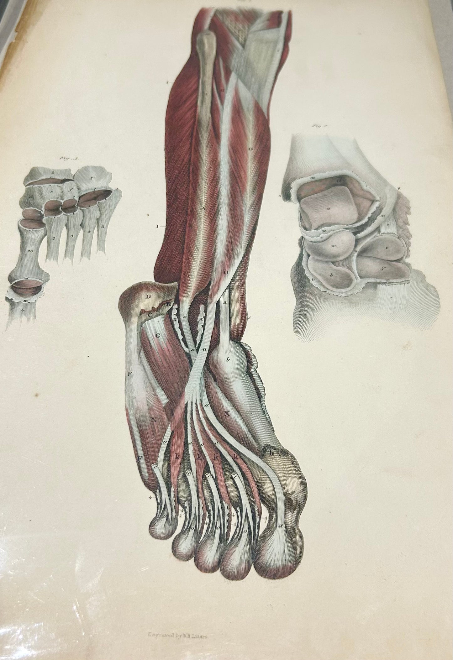 Original Lizar's Anatomical Print 19th Century Engraving – leg/foot/bones/cartilage original Plate LI