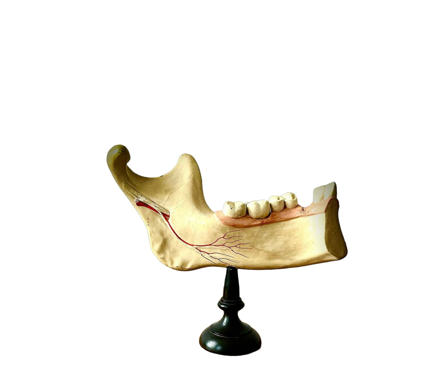Vintage Anatomical Jawbone & Teeth