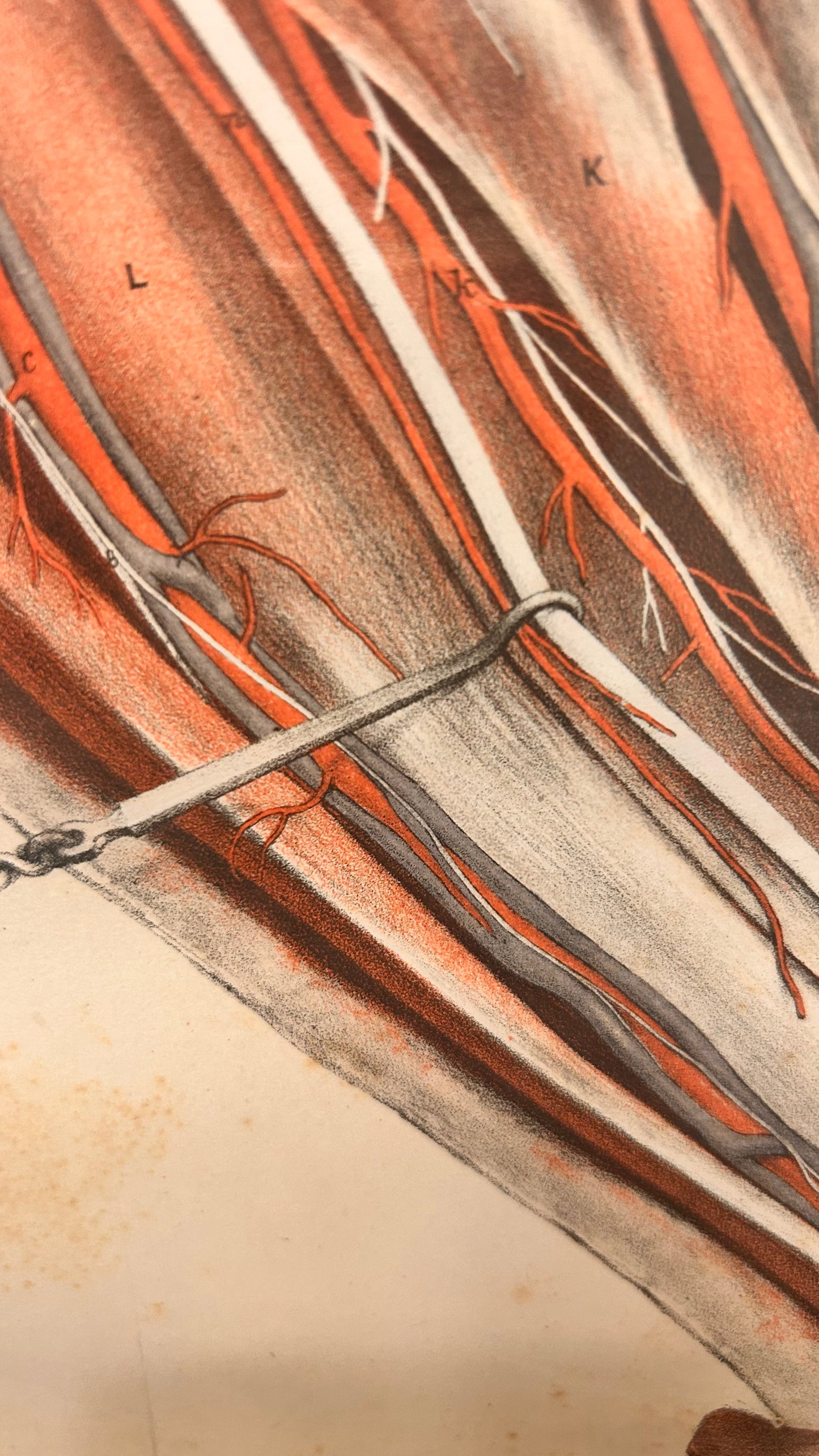 Anatomische Sektionszeichnung, 19. Jahrhundert, Unterarminnenseite, Tafel IX