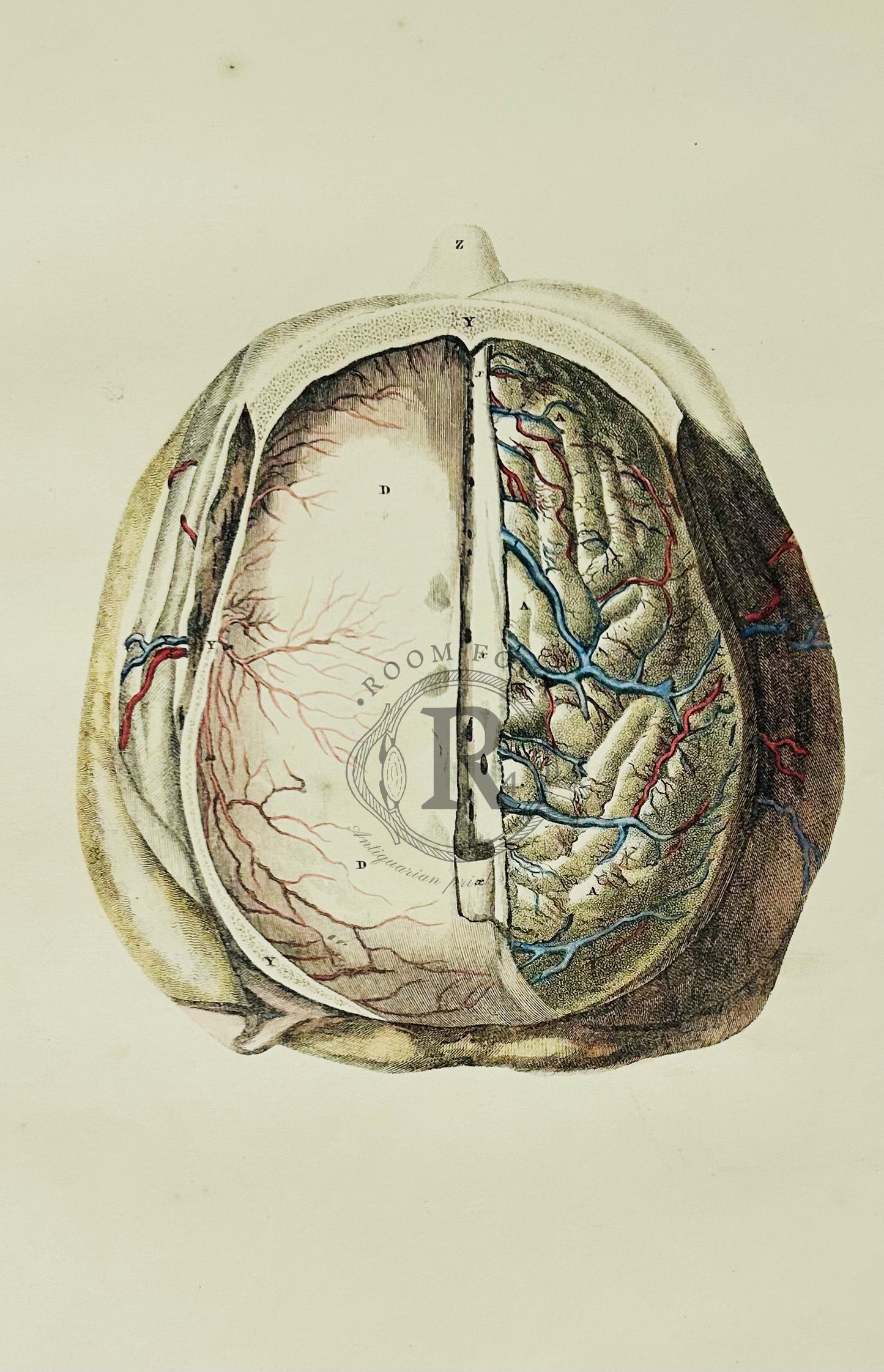 Lizars 19th Century Anatomical Illustration - The Brain - Plate LVII