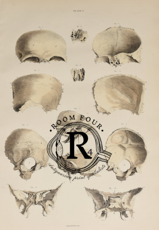 19th Century Original Anatomical Drawings by Lizars - Skull/Teeth/Jaw Bones
