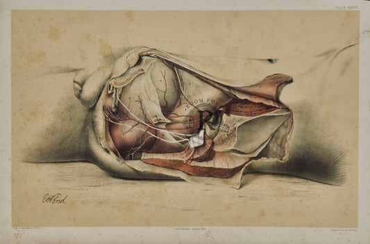 Anatomical Drawing 19th Century - Human Anatomy Pelvis - Post Mortem Dissection 

