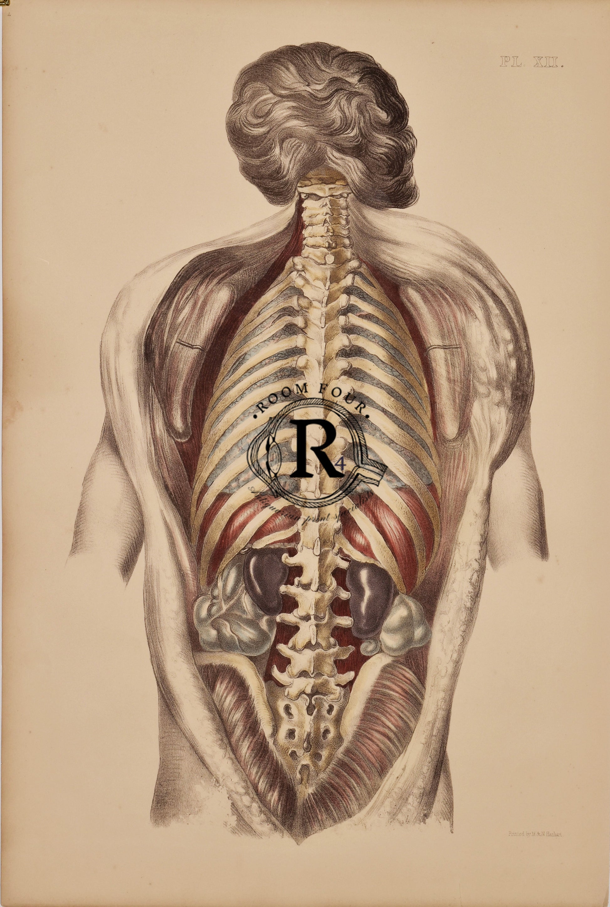 Sibson - Labeled Plate XII from a historical medical atlas. Vintage anatomical illustration of the human back showing layered muscles, spine, ribs, kidneys, and parts of the digestive system. Detailed view of musculoskeletal and internal organ structures from a historical medical atlas.