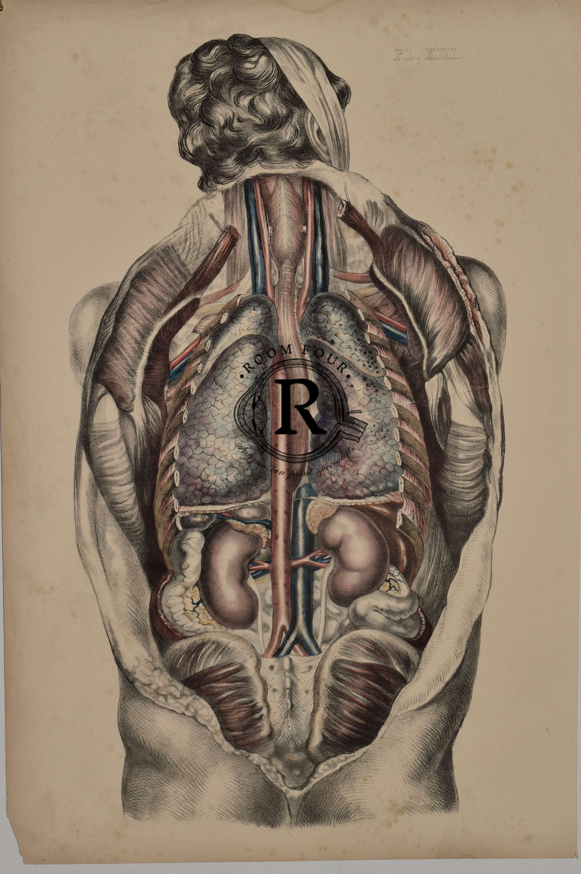 Vintage Posterior Anatomy Print — Plate XIII | 19th Century Medical Illustration of Internal Organs Sibson - Post  Mortem surgical teaching atlas - Vintage anatomical illustration of the human torso from the back, showing internal organs, spinal column, lungs, heart, kidneys, and major blood vessels. Labeled Plate XIII from a historical medical atlas.