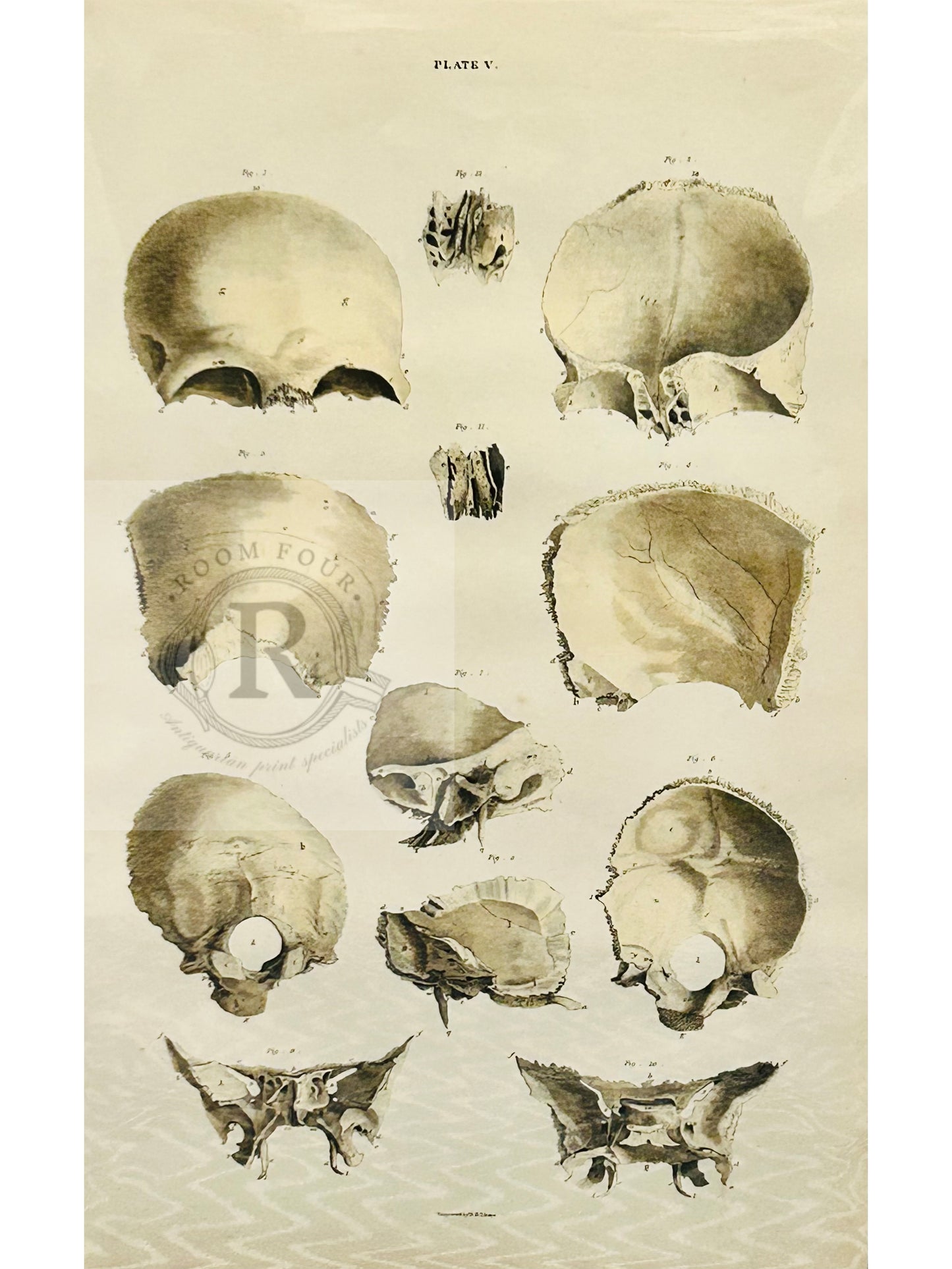 Antique Anatomical Engraving –  Human Skull  Plate V Lizars - | Vintage Medical Print