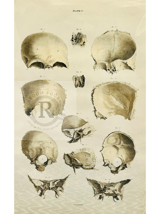 Antique Anatomical Engraving –  Human Skull  Plate V Lizars - | Vintage Medical Print