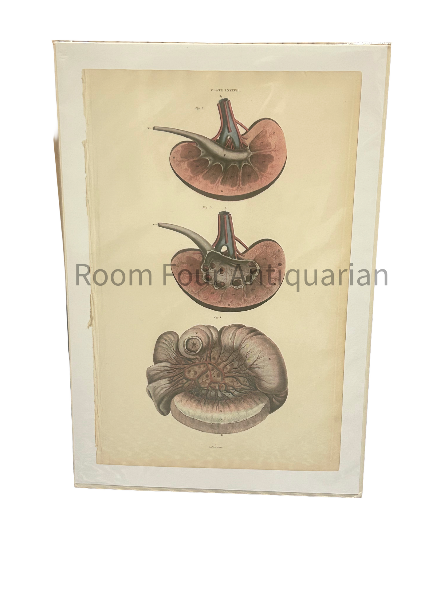 Anatomical Giclee Print - Abdominal Organs - Lizars Medical Engraving Plate LXXVIII