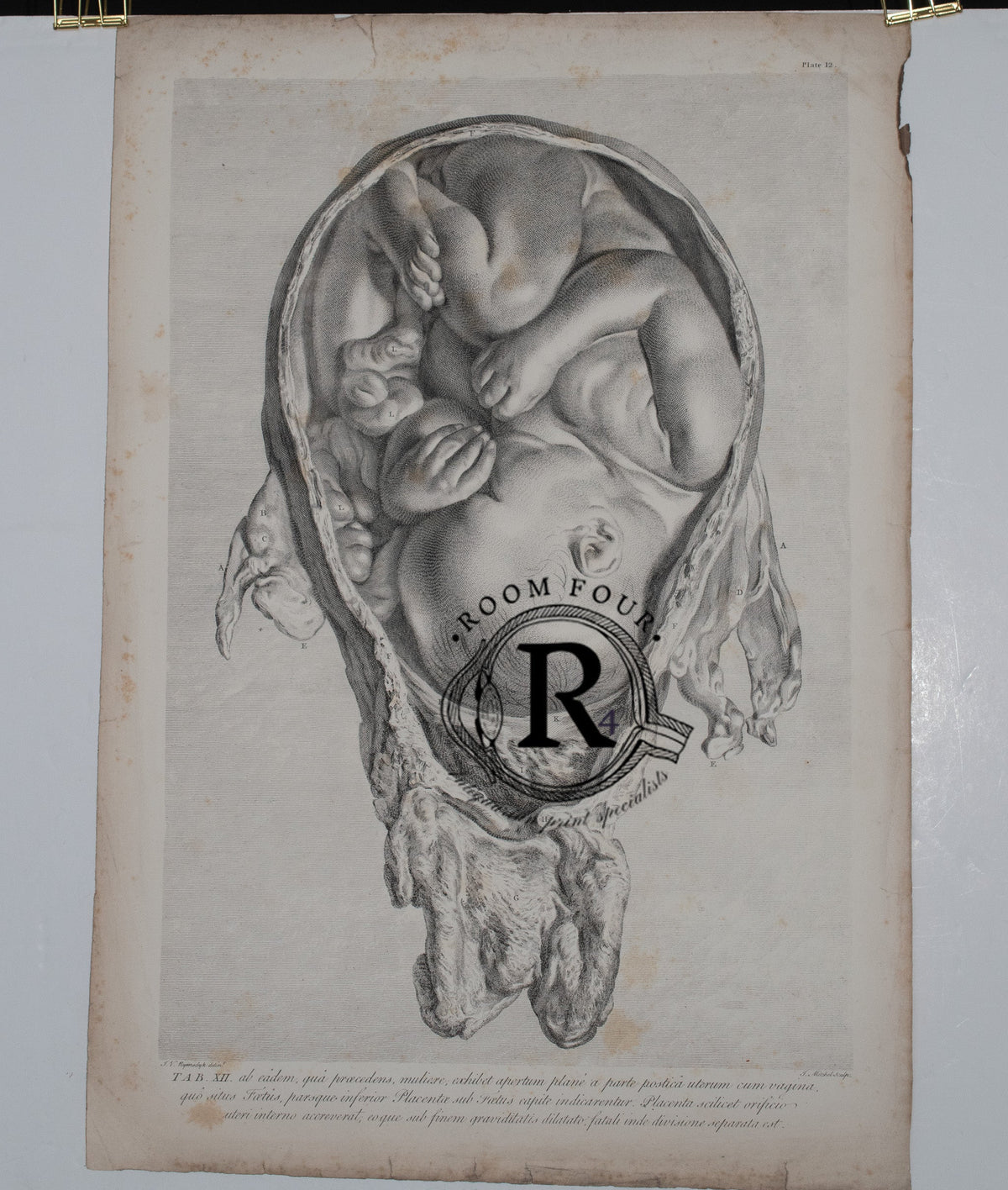 Original anatomical engraving by William Hunter showing full-term fetus in utero, engraved by Jan van Rymsdyk. 1851 