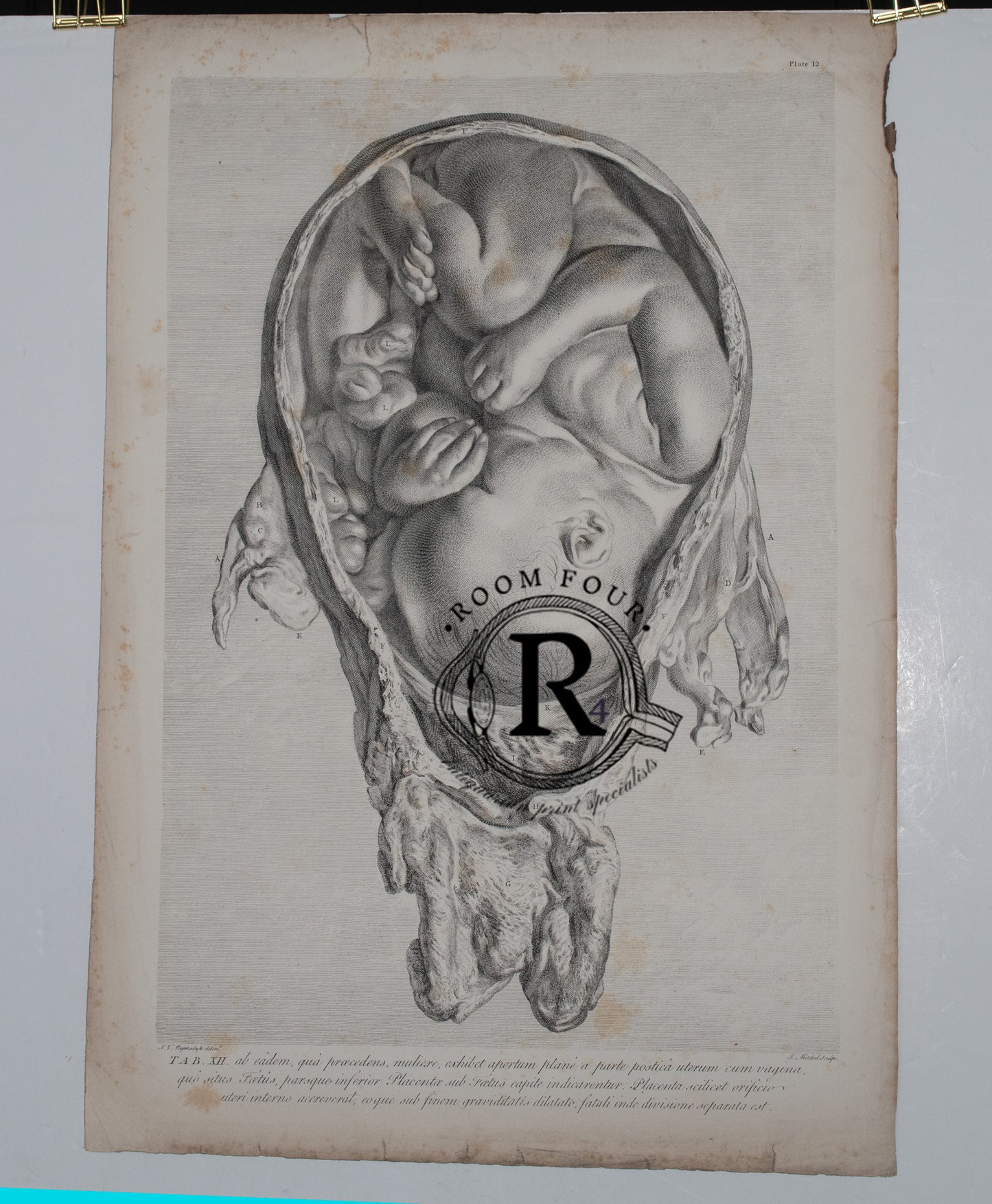 Original 1774 anatomical engraving by William Hunter showing full-term fetus in utero, engraved by Jan van Rymsdyk.