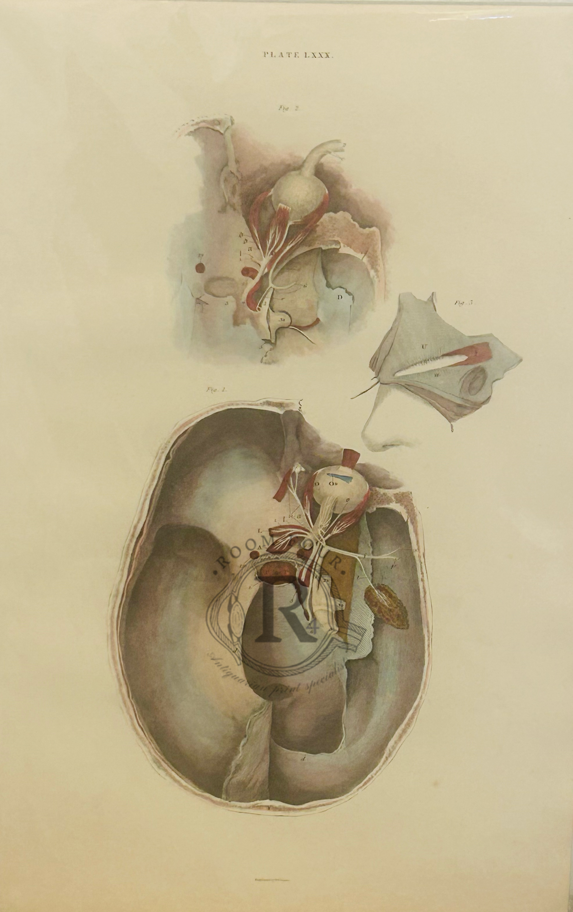 An original 200 year old hand-colored engraving from a System of Anatomical Plates of the Human Body.Edinburgh: [1823-1827] by John Lizars. Cranial Skull