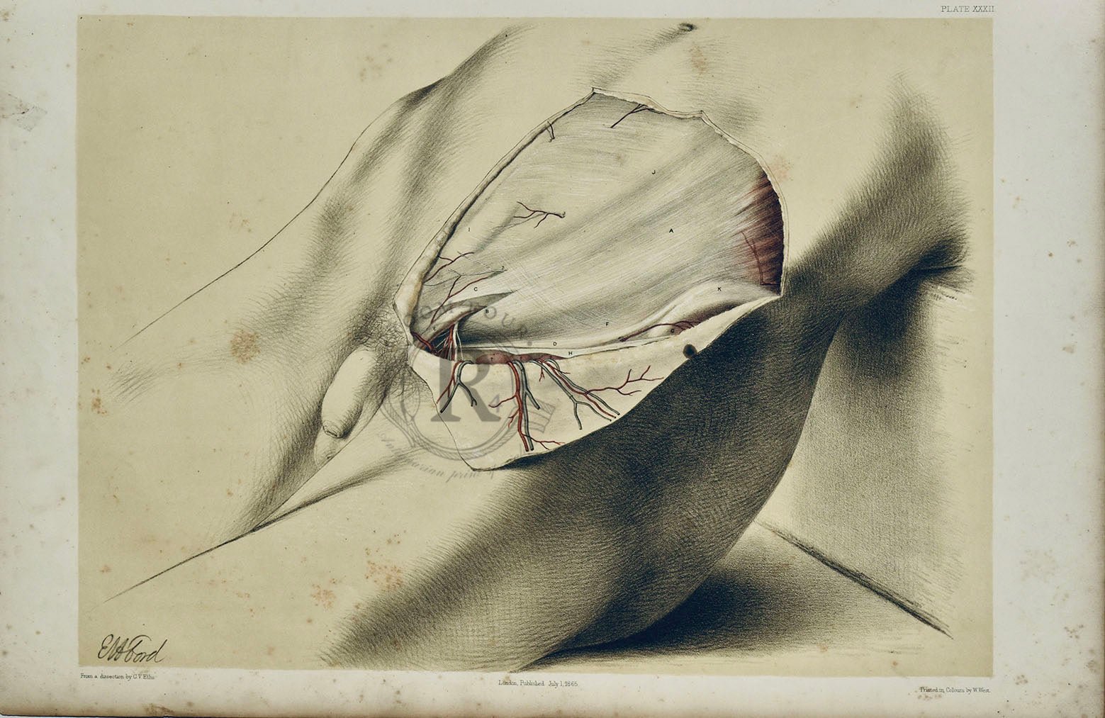 Anatomical Dissection Drawing 19th Century - Abdomen Plate XXXII - Room Four