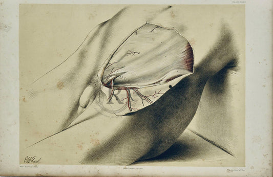 Anatomical Dissection Drawing 19th Century - Abdomen Plate XXXII - Room Four