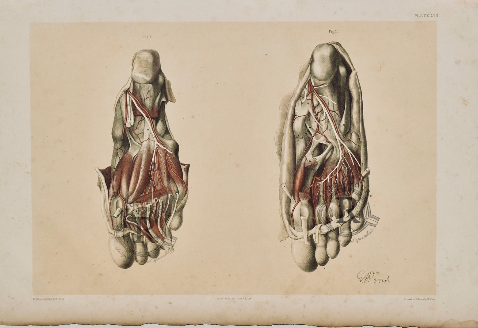 Anatomical Dissection Drawing 19th Century - Feet Plate LVII - Room Four