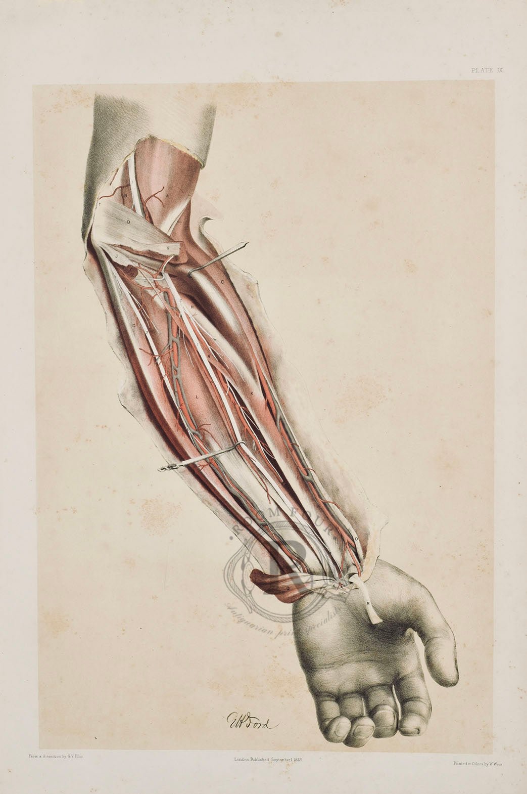 Anatomical Dissection Drawing 19th Century, Inner Forearm plate IX - Room Four