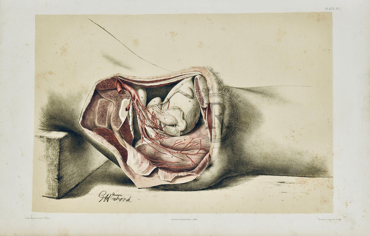 Anatomical Dissection Drawing 19th Century Lower Torso Plate XLI - Room Four