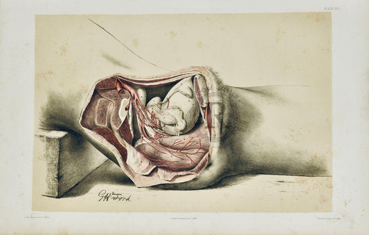 Anatomical Dissection Drawing 19th Century Lower Torso Plate XLI - Room Four