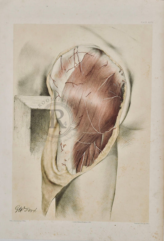 Anatomical Dissection Drawing 19th Century Plate XLVIII Maximus Gluteus - Room Four