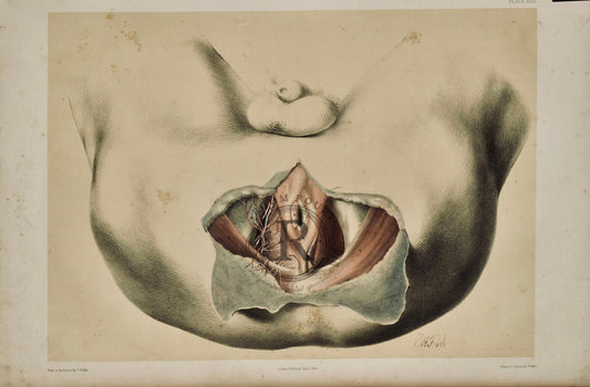 Anatomical Drawing 19th Century - Dissection Male Perineum plate XXIX - Room Four
