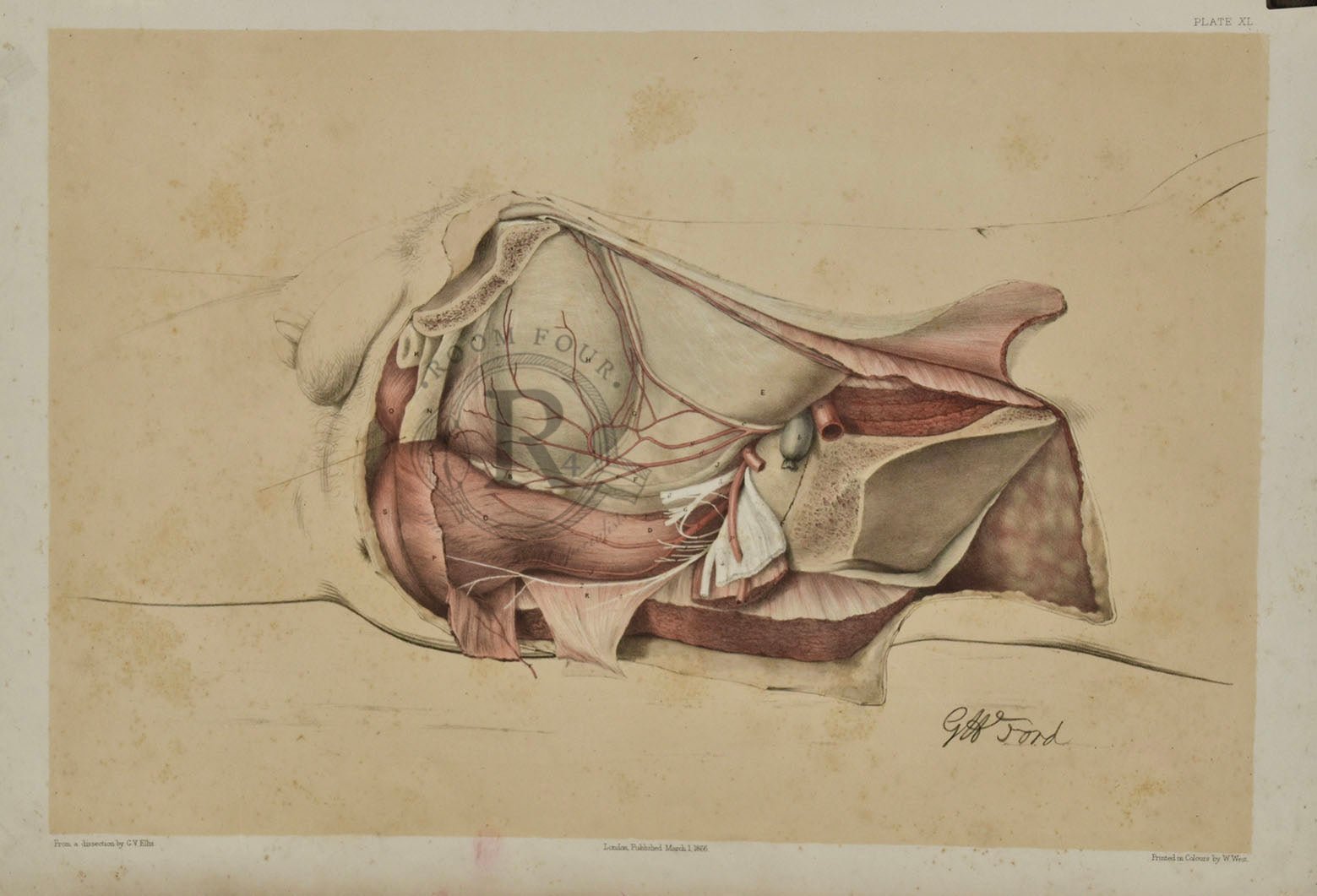 Anatomical Drawing 19th Century - Male Abdomen Dissection (plate XL) - Room Four