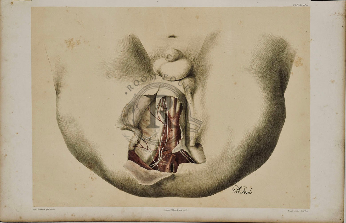 Anatomical Drawing 19th Century - Male Perineum plate XXX - Room Four