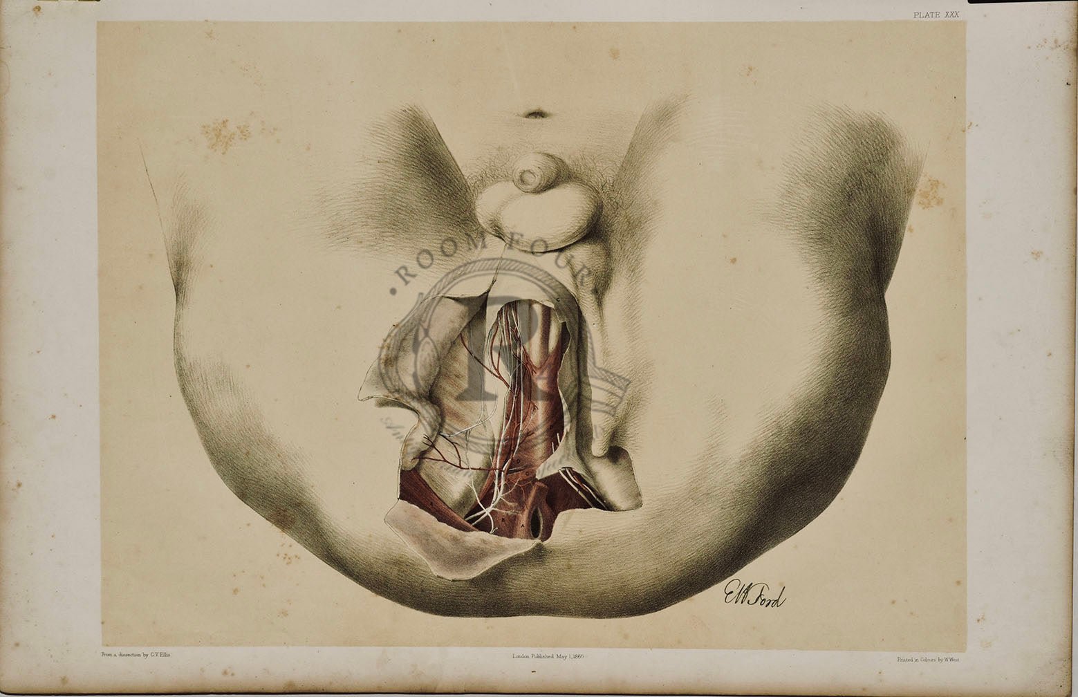 Anatomical Drawing 19th Century - Male Perineum plate XXX - Room Four