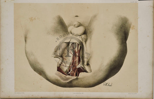 Anatomical Drawing 19th Century - Male Perineum plate XXX - Room Four