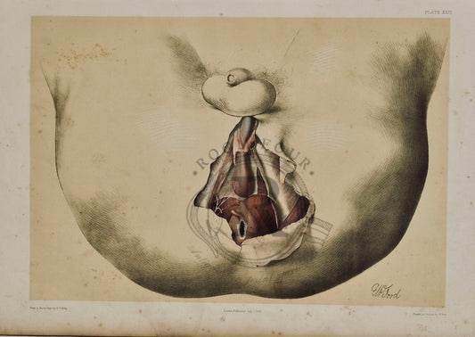 Anatomical Drawing 19th Century, Male Perineum, plate XXXI - Room Four