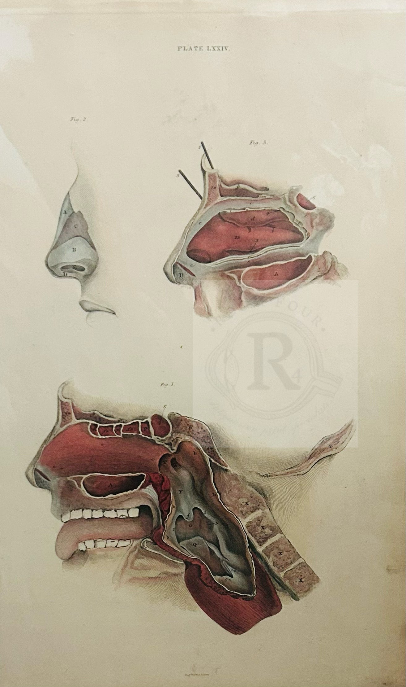 Detailed 19th-century anatomical engraving by John Lizars showing the human nasal cavity, mouth, and pharynx in cross-section, Plate LXXIV.
