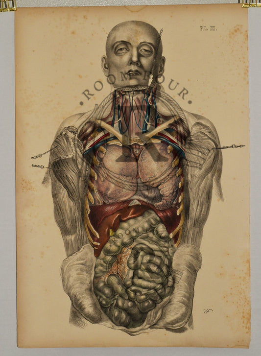 Anatomical Folio Art Surgical Post Mortem 19th Century - Room Four