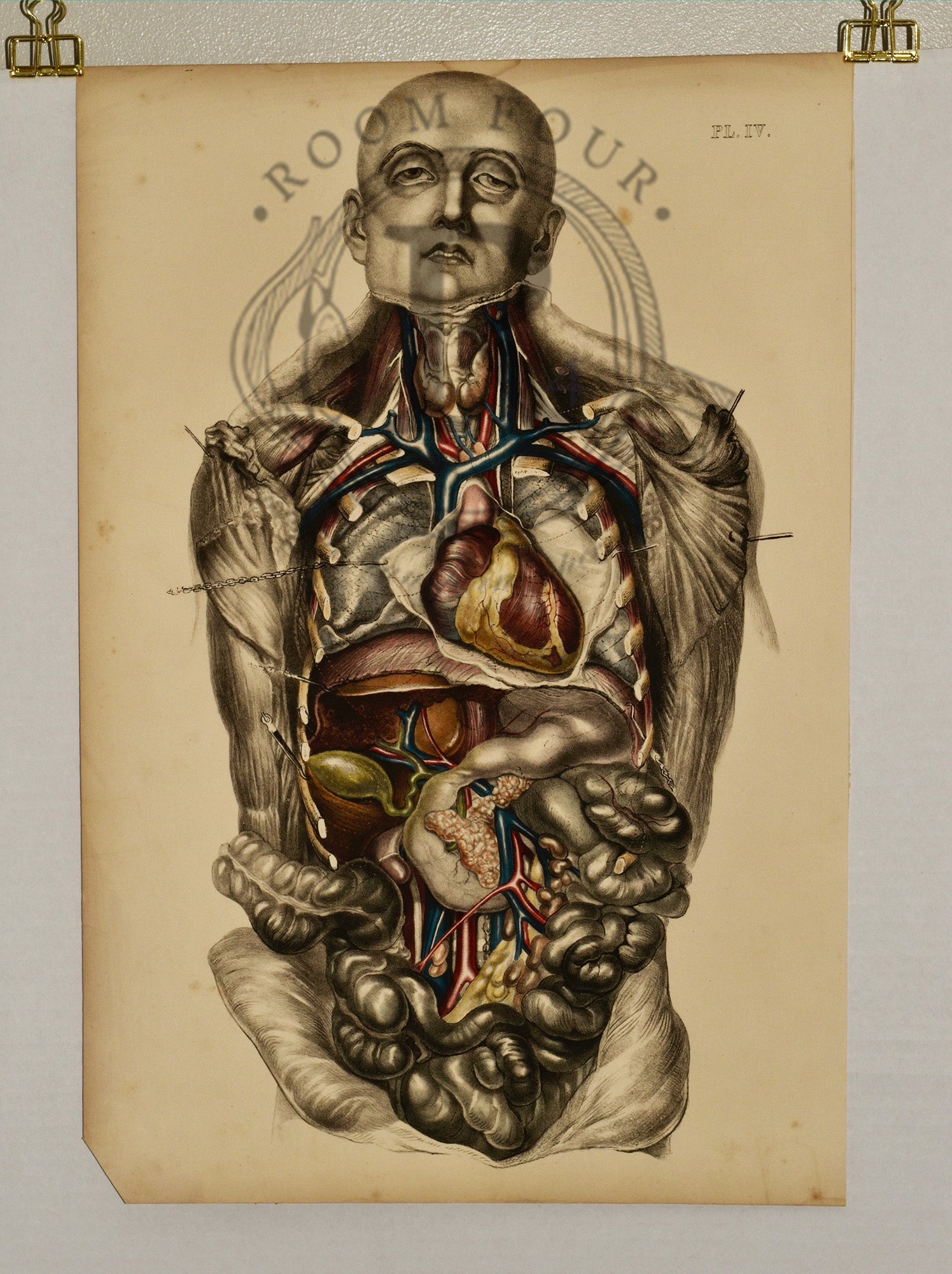 Anatomical Folio Art Surgical Post Mortem 19th Century - Room Four