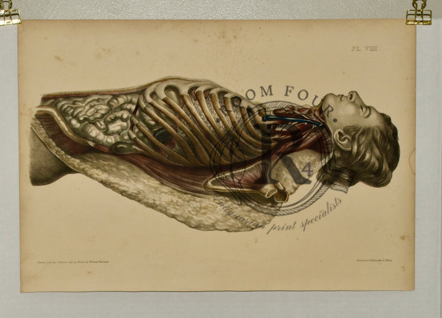 Anatomical Folio Art Surgical Post Mortem 19th Century - Room Four