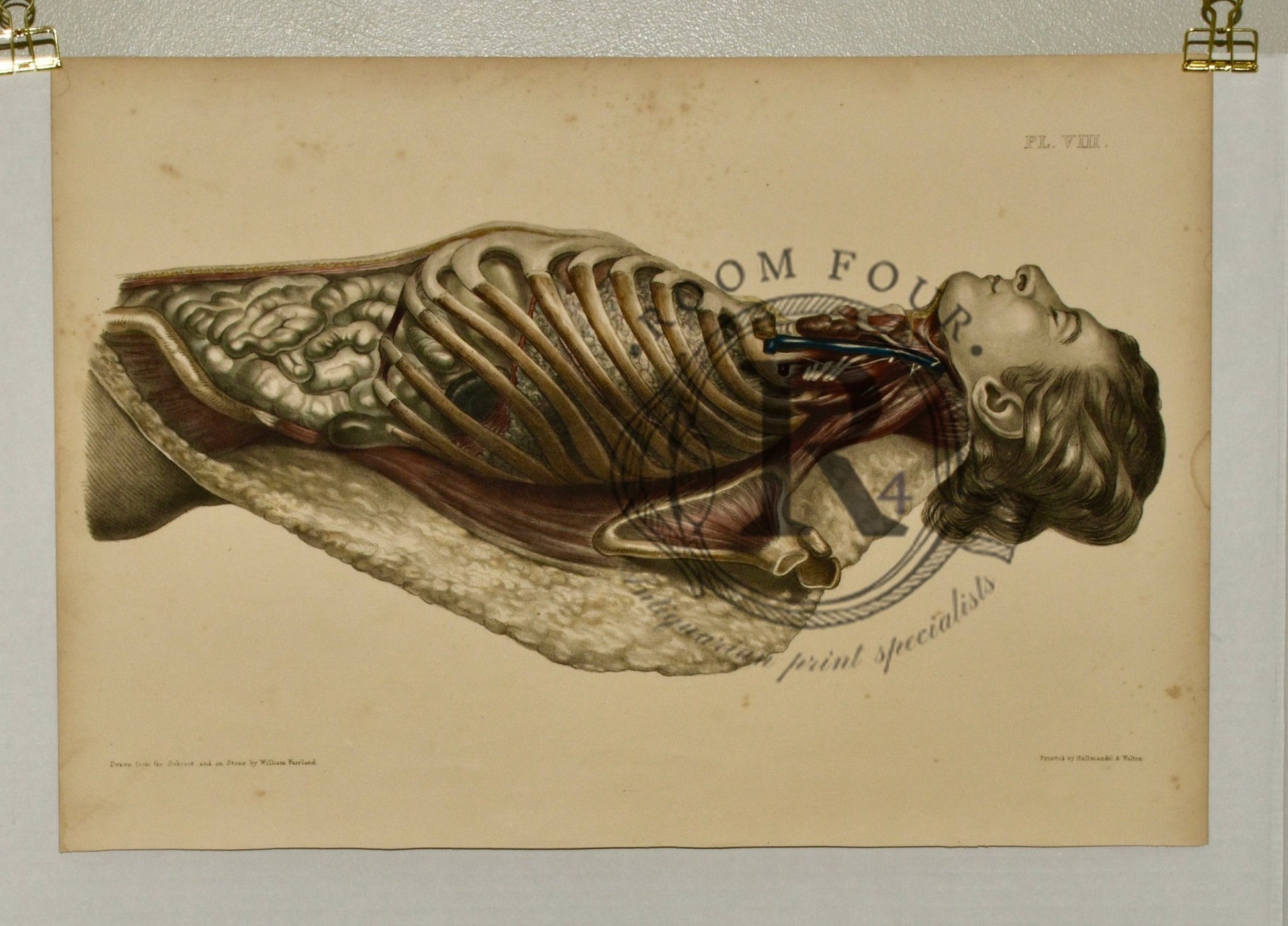 Anatomical Folio Art Surgical Post Mortem 19th Century - Room Four
