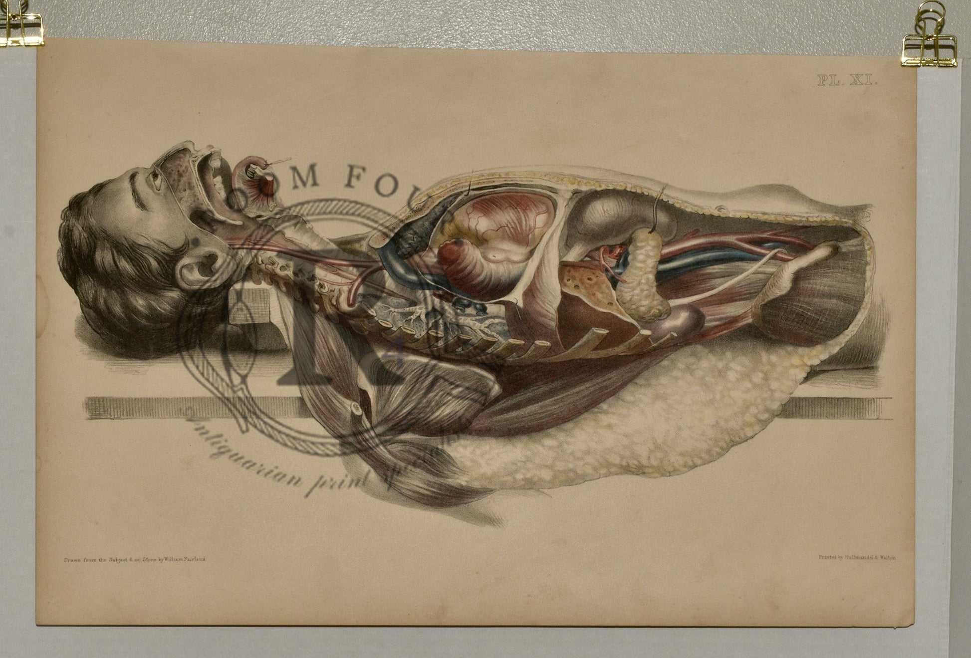 Anatomical Folio Art Surgical Post Mortem 19th Century - Room Four