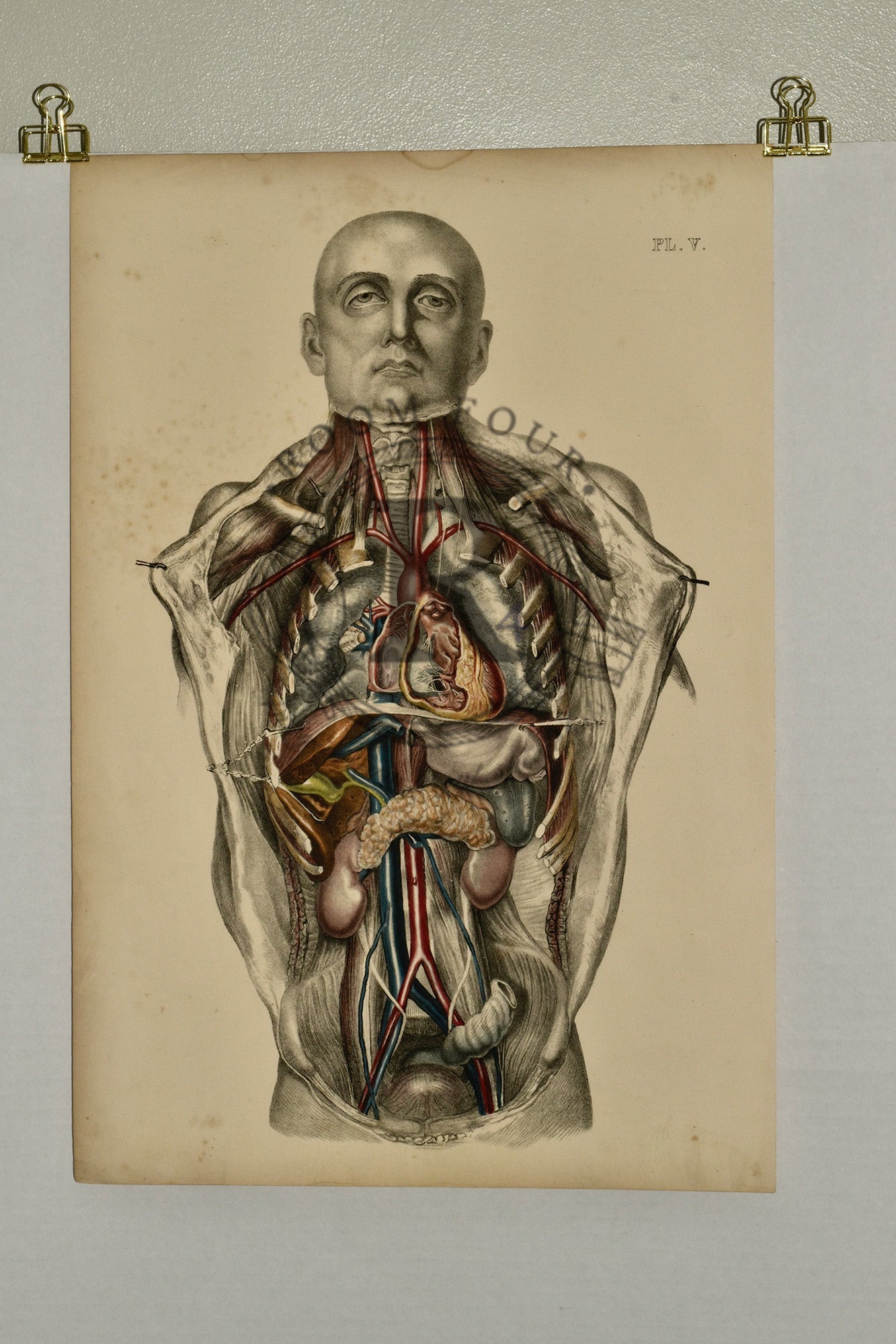 Anatomical Folio Art Surgical Post Mortem 19th Century - Room Four