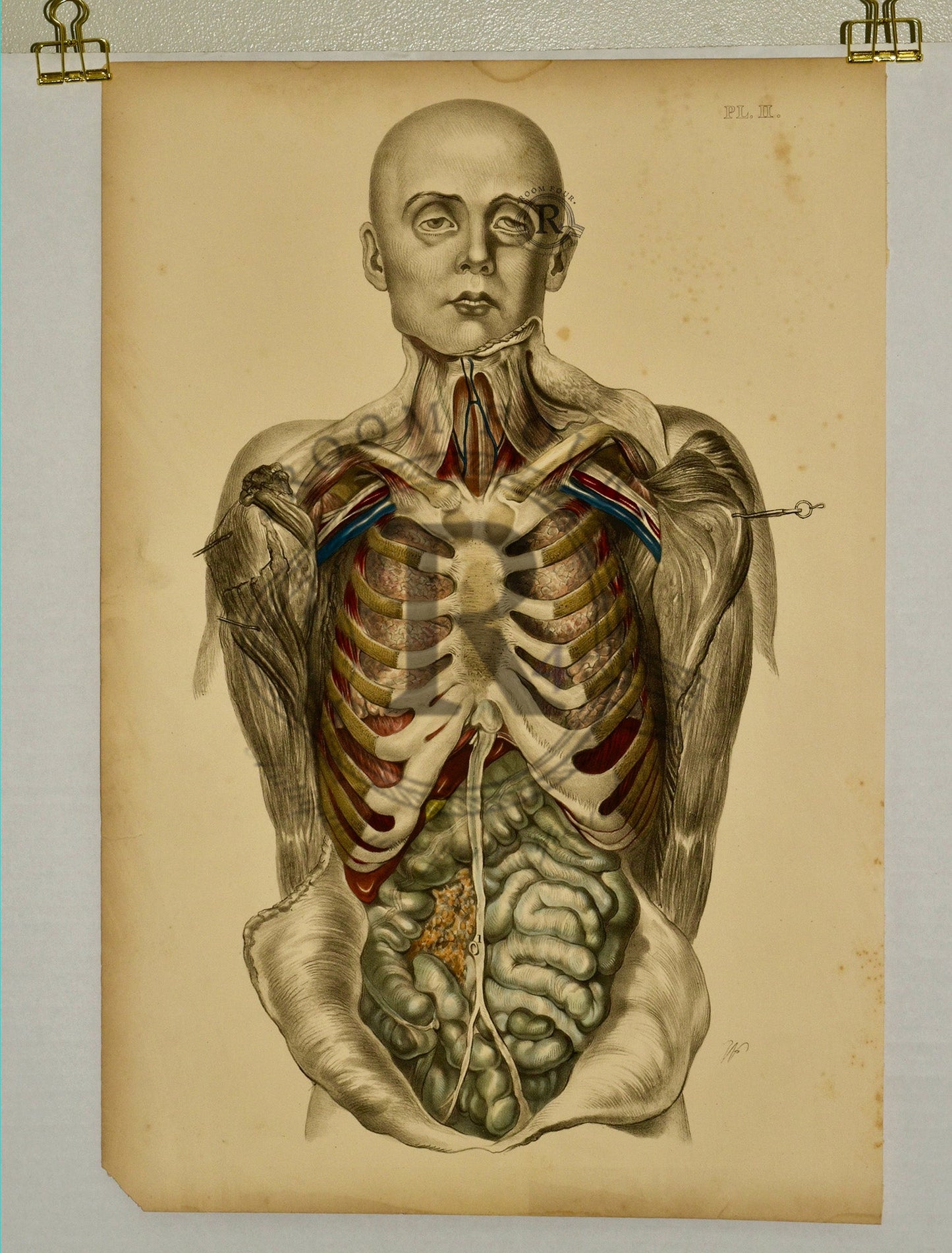 Anatomical Folio Art Surgical Post Mortem 19th Century - Room Four